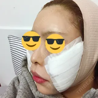 0日目の経過画像（2枚目）