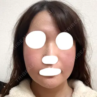 25日目の経過画像（1枚目）