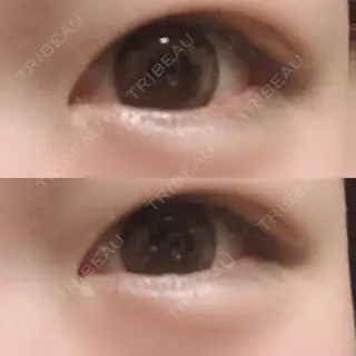 7日目の経過画像（1枚目）
