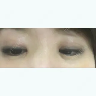 8日目の経過画像（2枚目）