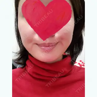 6日目の経過画像（1枚目）