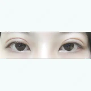 7日目の経過画像（1枚目）