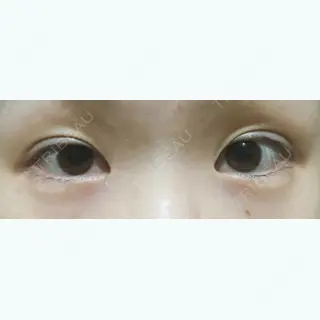 9日目の経過画像（1枚目）