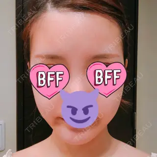 21日目の経過画像（1枚目）