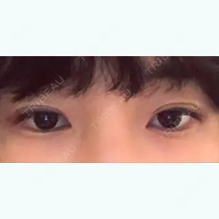 9日目の経過画像（1枚目）