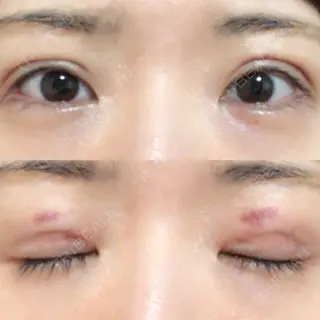 10日目の経過画像（1枚目）