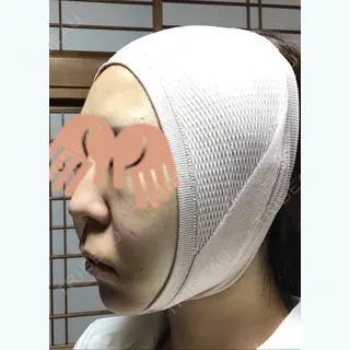 3日目の経過画像（2枚目）