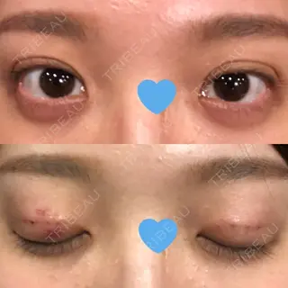 3日目の経過画像（1枚目）
