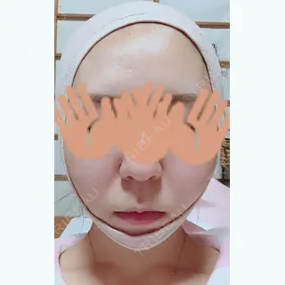 12日目の経過画像（1枚目）