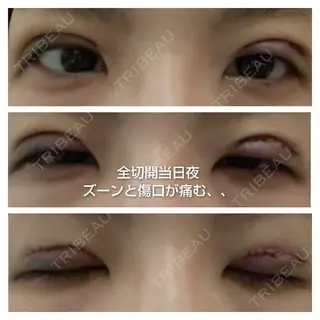 0日目の経過画像（1枚目）