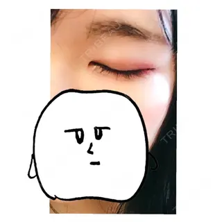 16日目の経過画像（3枚目）