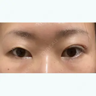 496日目の経過画像（1枚目）