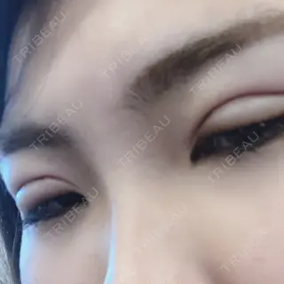 1日目の経過画像（1枚目）