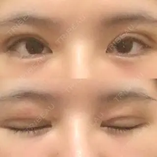 7日目の経過画像（1枚目）