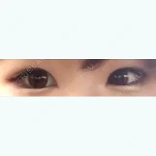 7日目の経過画像（1枚目）
