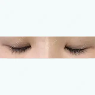 9日目の経過画像（1枚目）