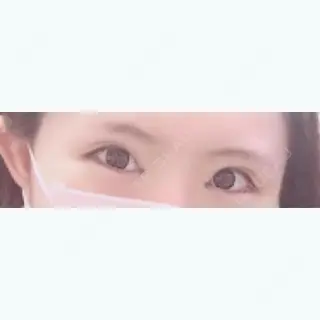 4日目の経過画像（1枚目）