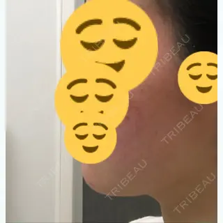 18日目の経過画像（3枚目）