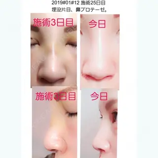 25日目の経過画像（1枚目）
