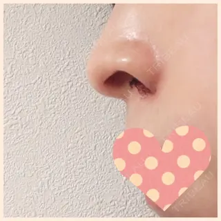 1日目の経過画像（2枚目）