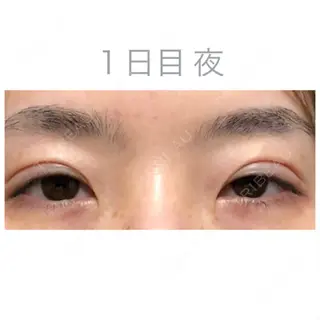 1日目の経過画像（1枚目）