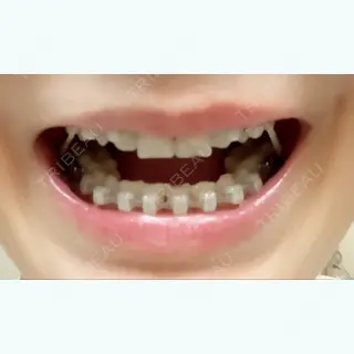 772日目の経過画像（1枚目）