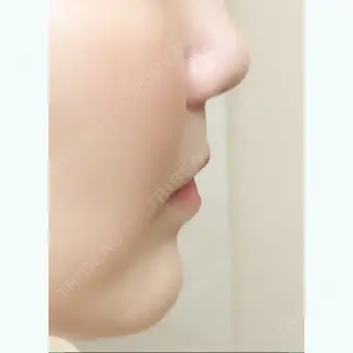 772日目の経過画像（3枚目）