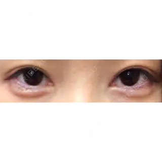 2日目の経過画像（1枚目）
