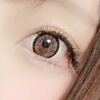 0日目の経過画像（1枚目）