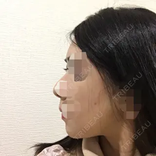 11日目の経過画像（2枚目）