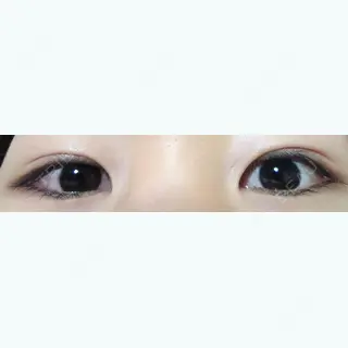 15日目の経過画像（1枚目）