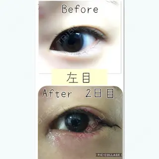2日目の経過画像（3枚目）