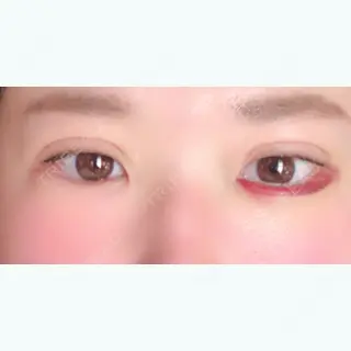 7日目の経過画像（1枚目）
