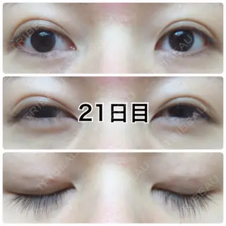 21日目の経過画像（1枚目）