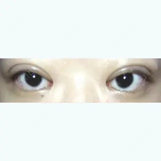 7日目の経過画像（1枚目）