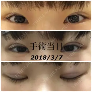 0日目の経過画像（1枚目）