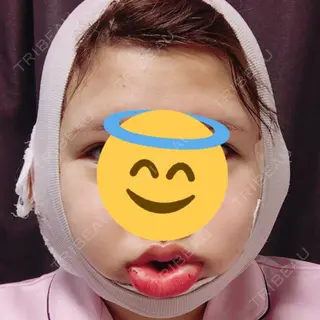 1日目の経過画像（1枚目）