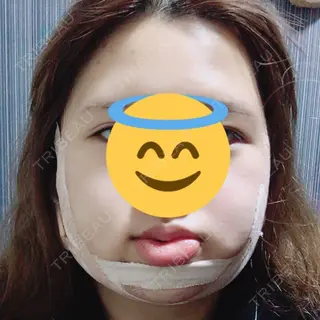 2日目の経過画像（1枚目）