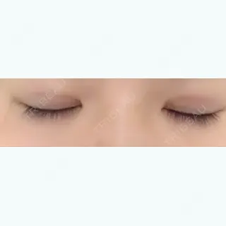 23日目の経過画像（3枚目）