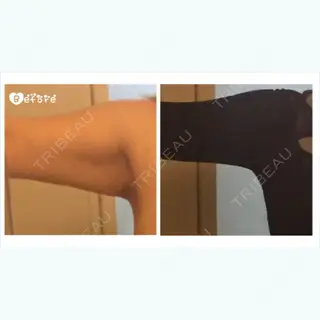 2日目の経過画像（1枚目）