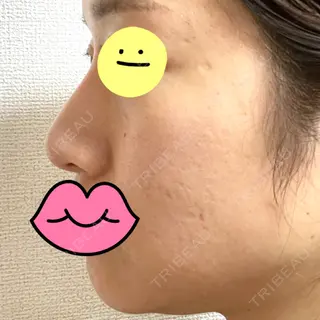 477日目の経過画像（2枚目）