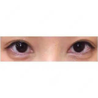 6日目の経過画像（1枚目）
