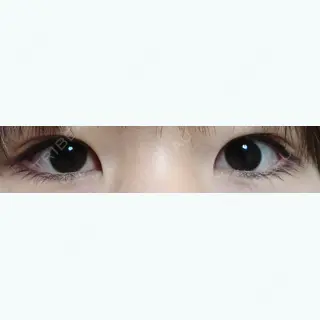 17日目の経過画像（1枚目）