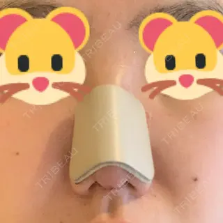 3日目の経過画像（1枚目）