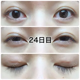 24日目の経過画像（1枚目）