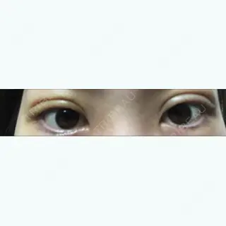 2日目の経過画像（2枚目）