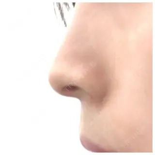 7日目の経過画像（2枚目）