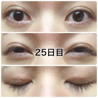 25日目の経過画像（2枚目）