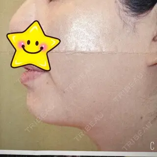 25日目の経過画像（2枚目）
