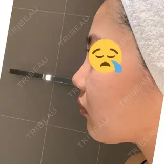 1日目の経過画像（1枚目）